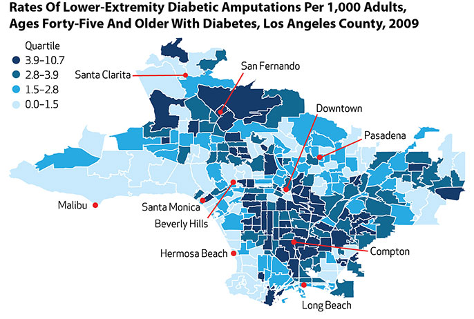 infographic - diabetic amputations