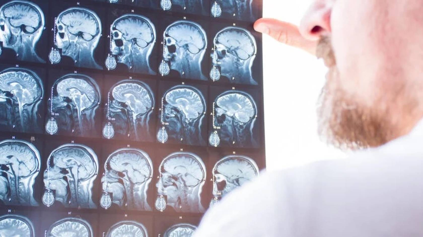 A shot over the shoulder from behind a bearded man wearing a white lab coat, holding a grid of brain scans up to a light wall to inspect them