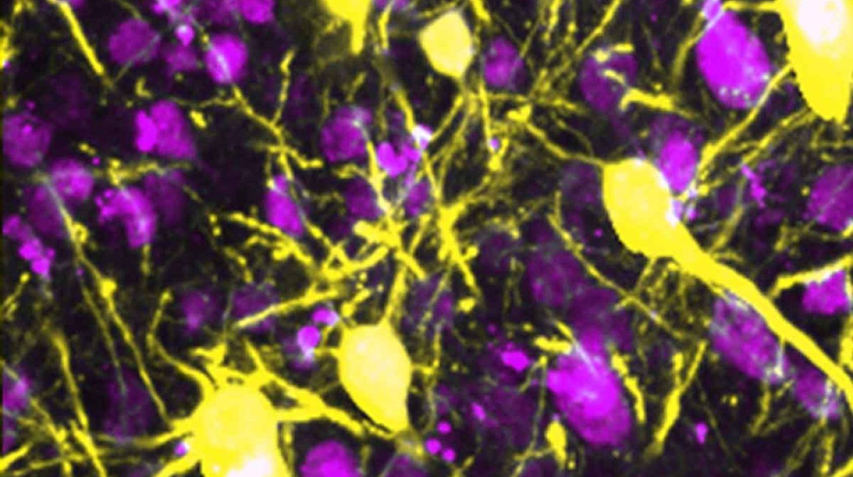 neurons imaged in bright pink and yellow colors