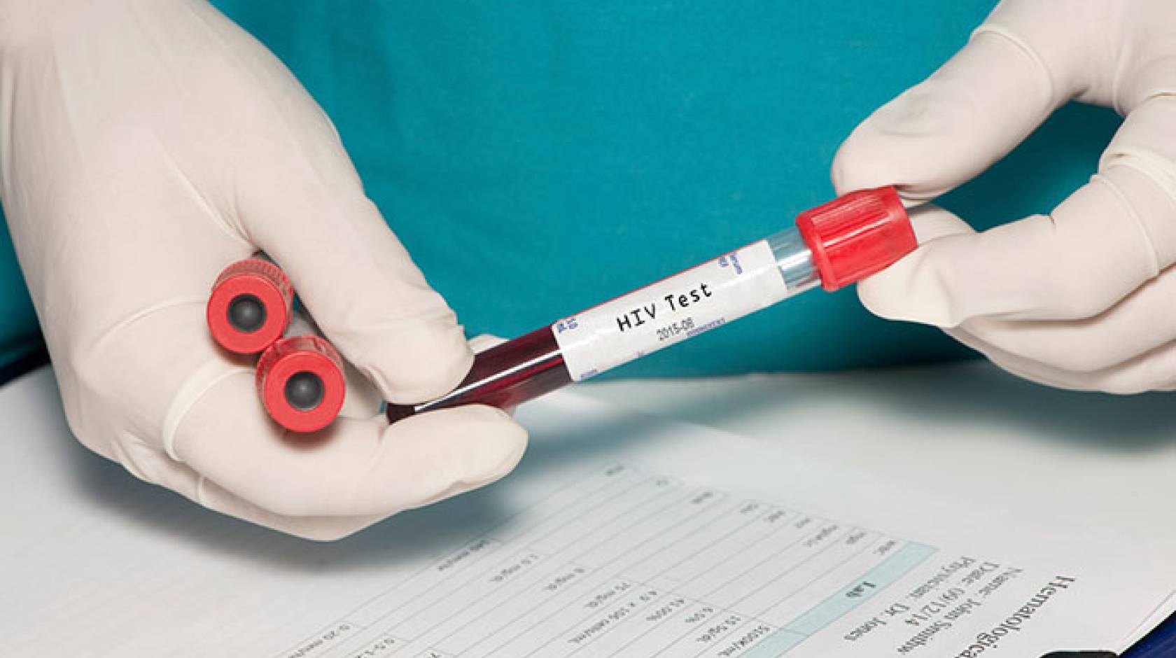 vial of blood labeled HIV test