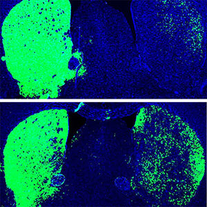 dopaminergic neurons