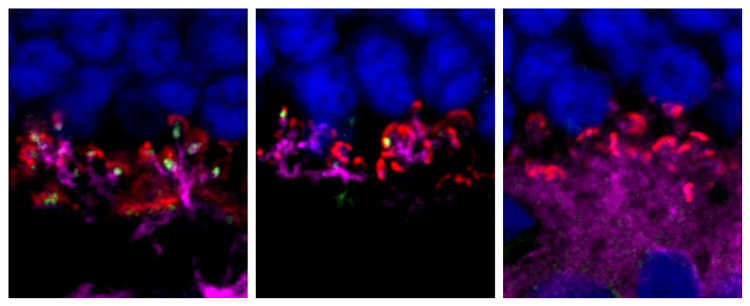 An image that shows a cross-section of the retina and the ON-bipolar cells targeted by gene therapy. 