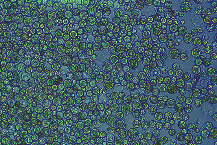 lots of green, circular leaf protoplasts