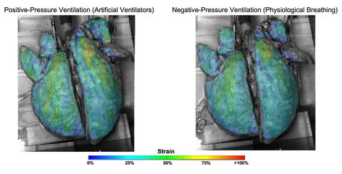 Lungs on a ventilator vs. lungs physiologically breathing