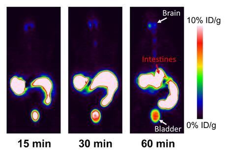 PET scan images show that orally administered EPP6 accumulated in the intestines and made its way into the brain and bladder through blood circulation.