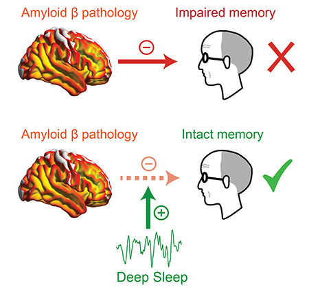 Diagram of a brain and an arrow to someone's head with a red X mark, then a brain and an arrow to someone's head with a green checkmark, indicating deep sleep