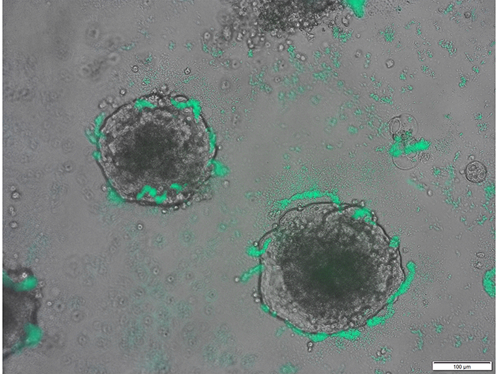 Acinetobacter baylyi (green) bacteria surround clumps of colorectal cancer cells in a dish