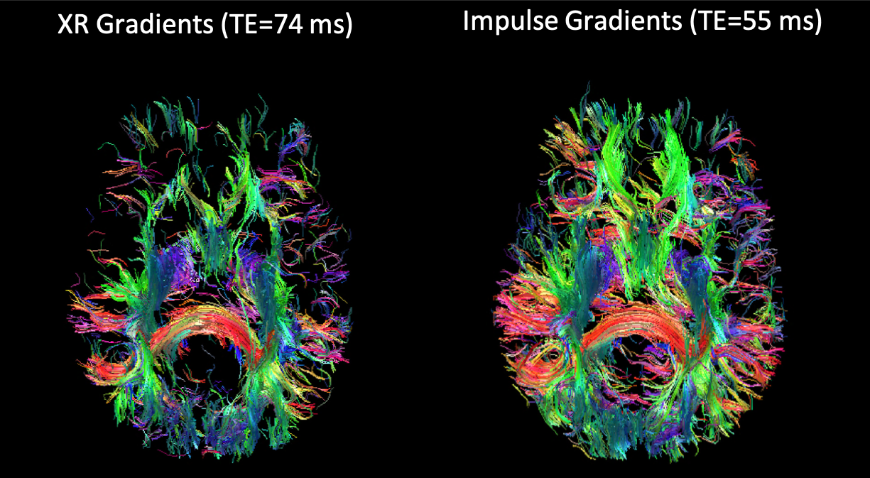 Colorful green red and purple maps of the brain made by diffusion MRI imaging