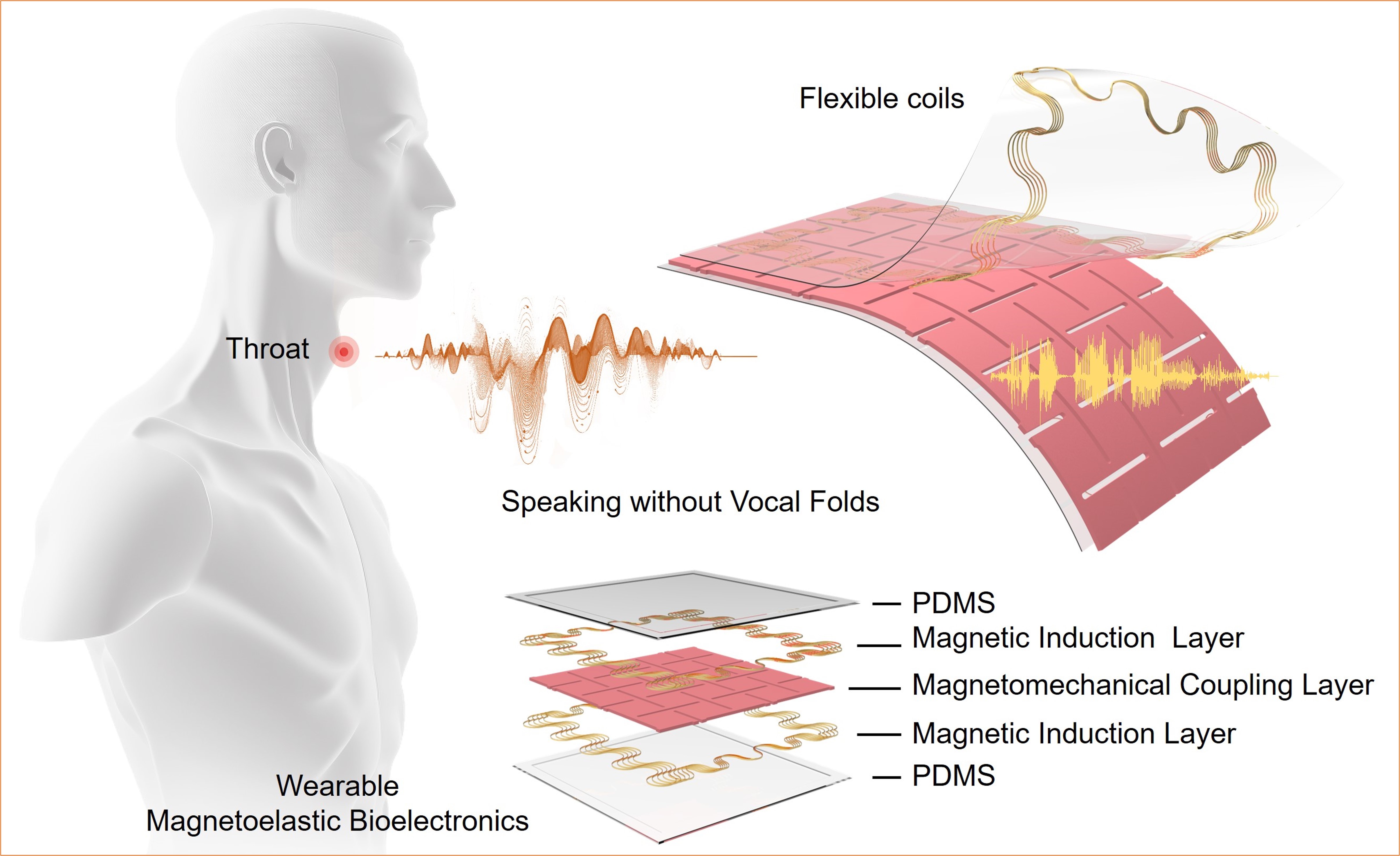 an illustration of the vocal cord device