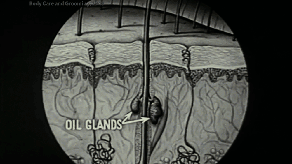 Vintage animation showing a schematic view of a pimple forming from a cross-section of the epidermis, with oil glands labeled