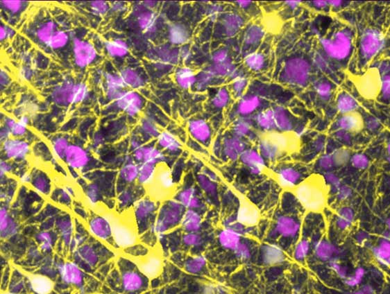 microscopy showing connections between neurons
