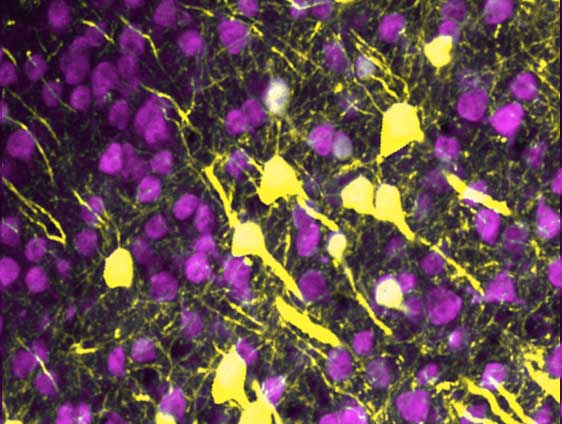 microscopy showing connections between neurons