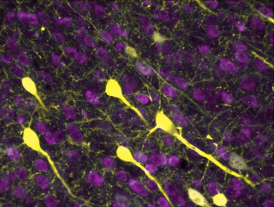 microscopy of connections between neurons