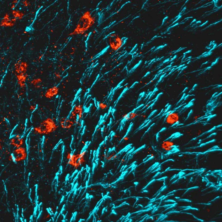 imaging of brain activity