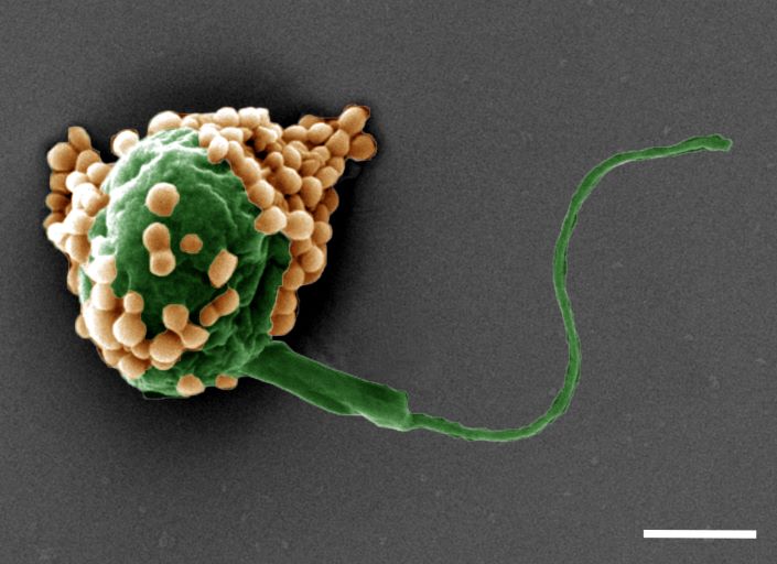 microscopic image of an algae microrobot dotted with small particles