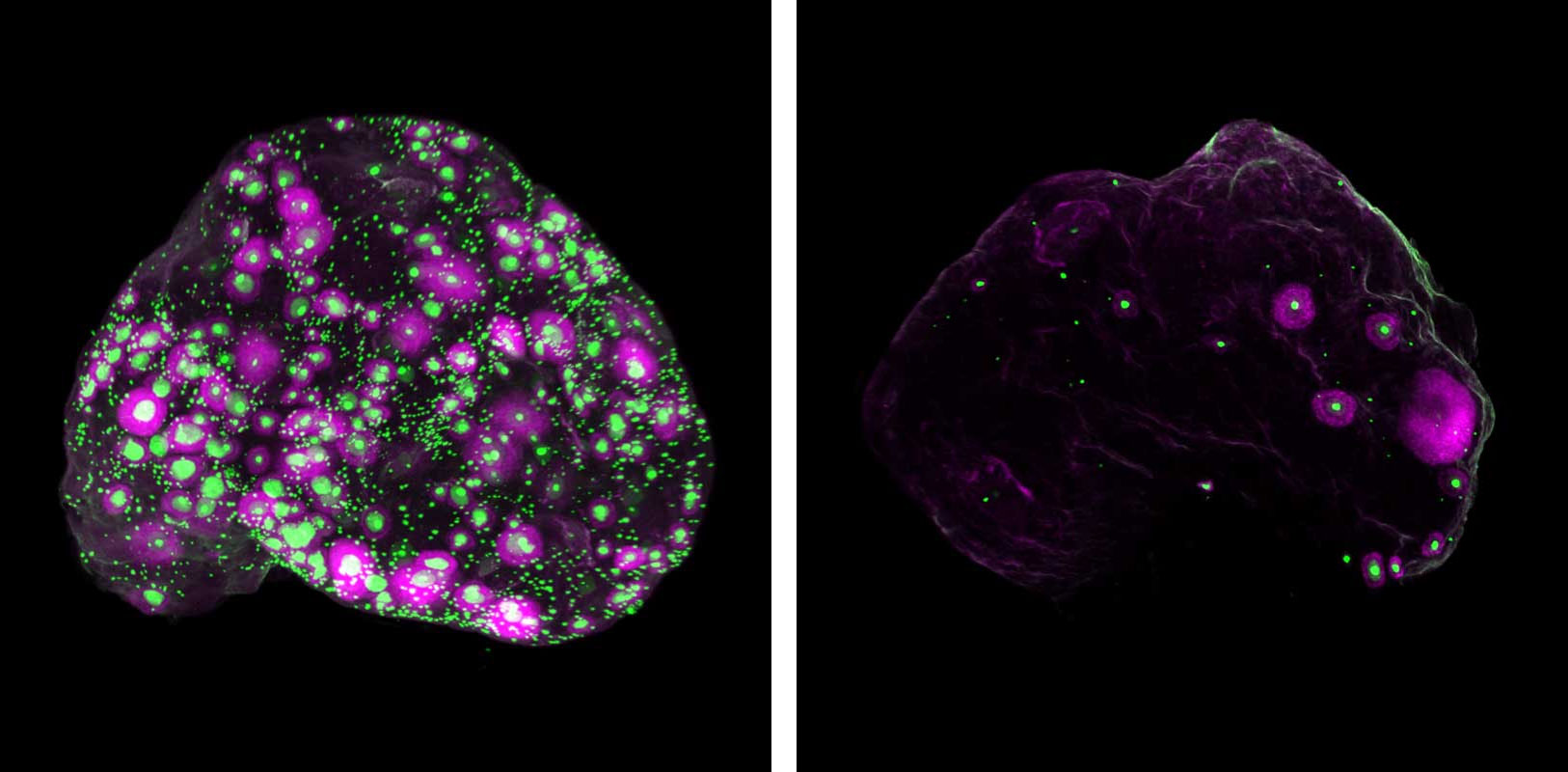 ChatGPT said: Fluorescent microscope images comparing two mouse ovaries. The ovary on the left is densely speckled with bright green and magenta spots, indicating numerous developing follicles, while the ovary on the right shows far fewer green and magenta spots, suggesting reduced follicle activity. Both are shown against a black background.