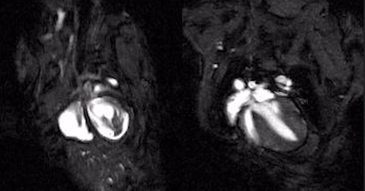 MRI photo of mouse's beating heart