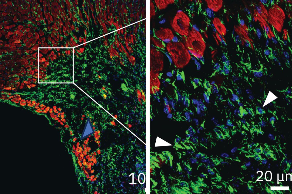 Fluorescent micrograph of tissue showing densely packed red cells interwoven with green, branching structures and scattered blue nuclei. On the left, a lower-magnification view includes a white boxed region and connecting lines that indicate a zoomed-in area. On the right, a higher-magnification view reveals fine green cellular processes surrounding blue nuclei beneath large red cell bodies. White arrowheads point to specific green structures of interest.