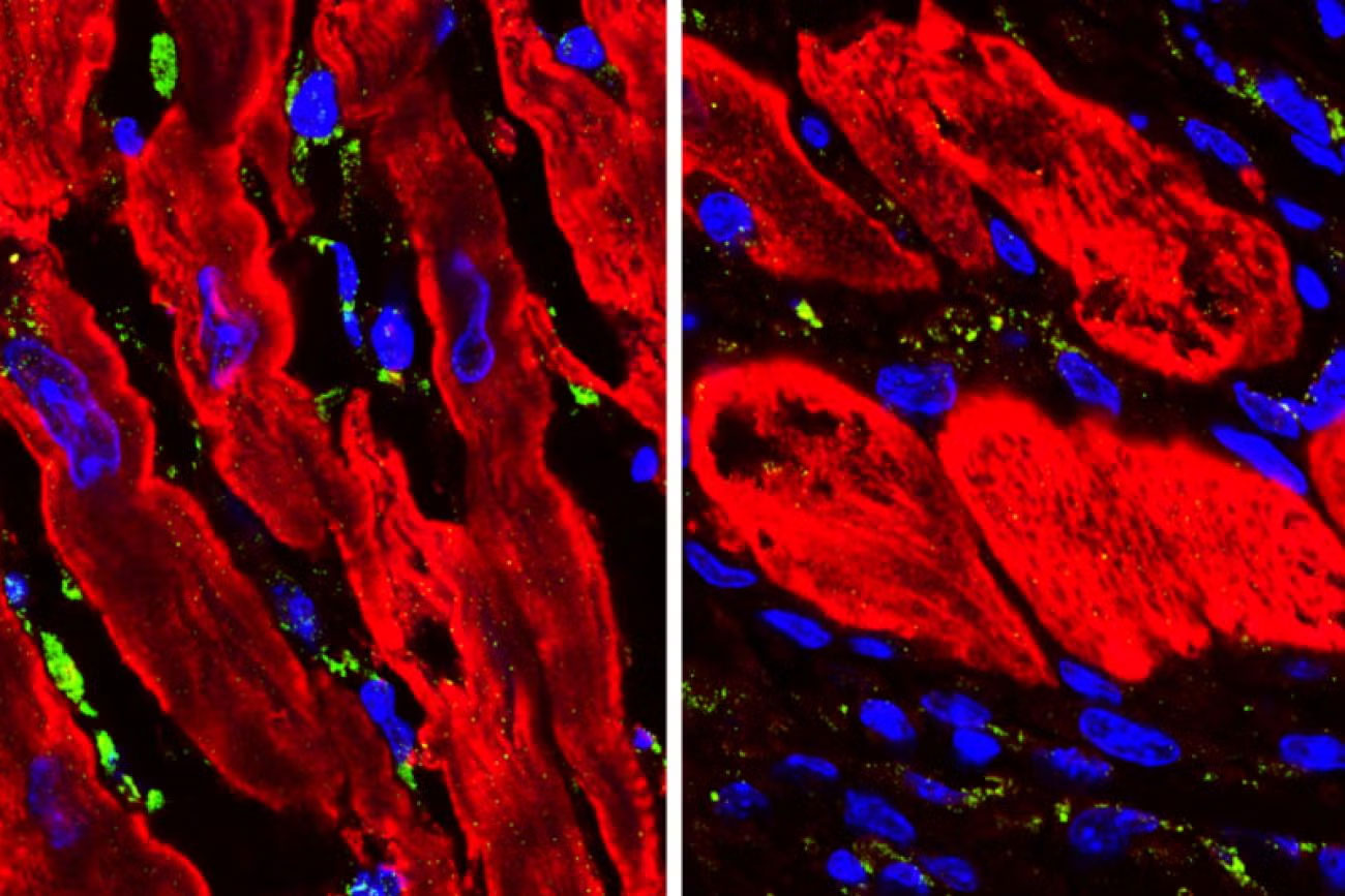 Side-by-side fluorescent micrographs of tissue sections showing elongated red muscle fibers arranged in parallel. Bright blue oval nuclei are scattered between and within the fibers, while small green punctate signals appear between fibers and along their edges. The left panel shows more densely packed, wavy fibers, while the right panel shows thicker, more separated fibers with prominent blue nuclei against a dark background.
