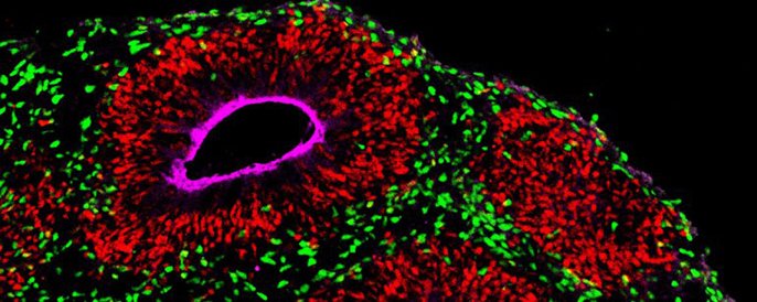 Lab-grown organdies will accelerate research