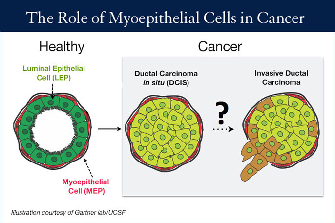 breast cell graphic