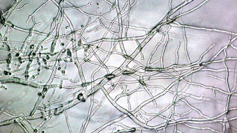 Mycelium of an unknown mold