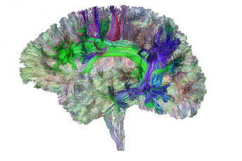 image of brain's white matter