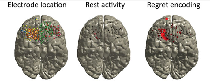 comparison of brain regions