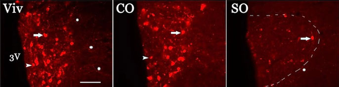 oxytocin in the hypothalamus