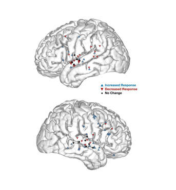Two brain illustrations, demonstrating increased, decreased and no change response levels with triangles