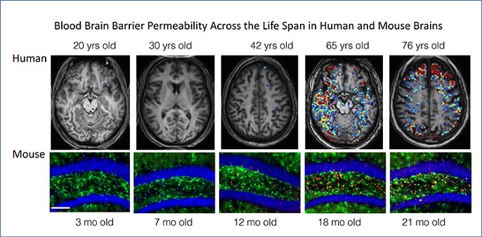 Enhanced MRI