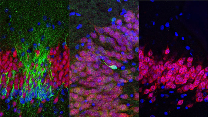 Young neurons (green) are shown in the human hippocampus at the ages of (from left) birth, 13 years old and 35 years old.