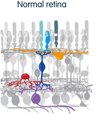 diagram of normal retina layers