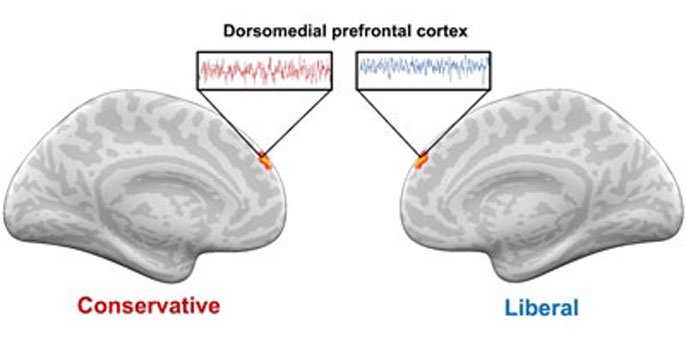 Partisan brain reaction illustration