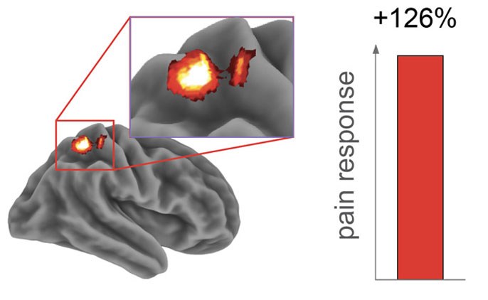 Graphic of activity in the somatosensory cortex after a sleepless night.