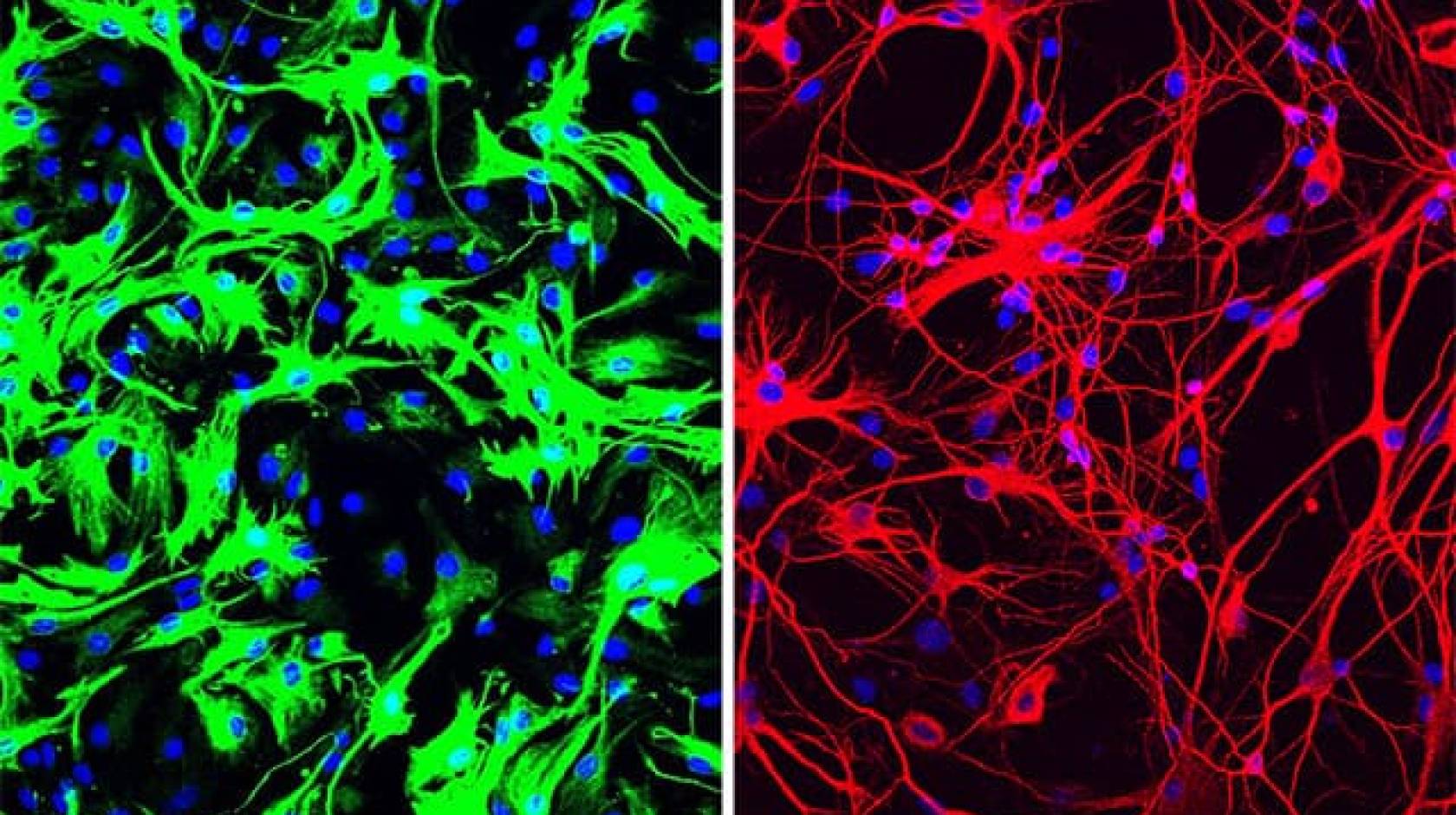 Left: mouse astrocytes (green) before reprogramming; Right: neurons (red) induced from mouse astrocytes after reprogramming with PTB antisense oligonucleotide treatment.
