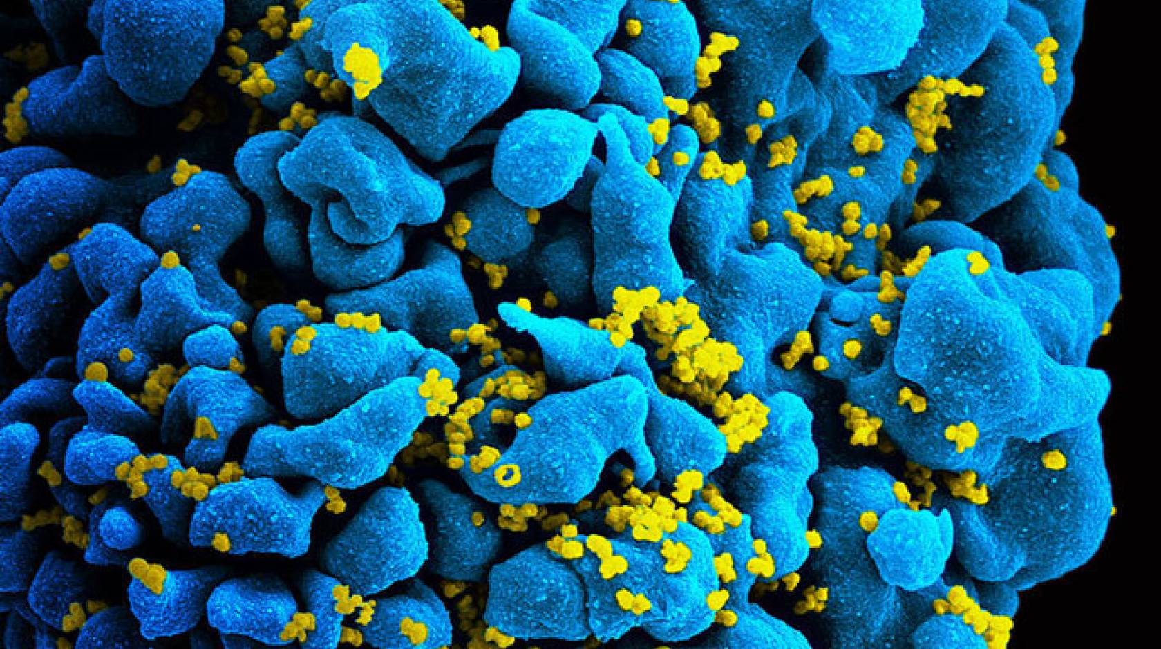 UCLA HIV T cell