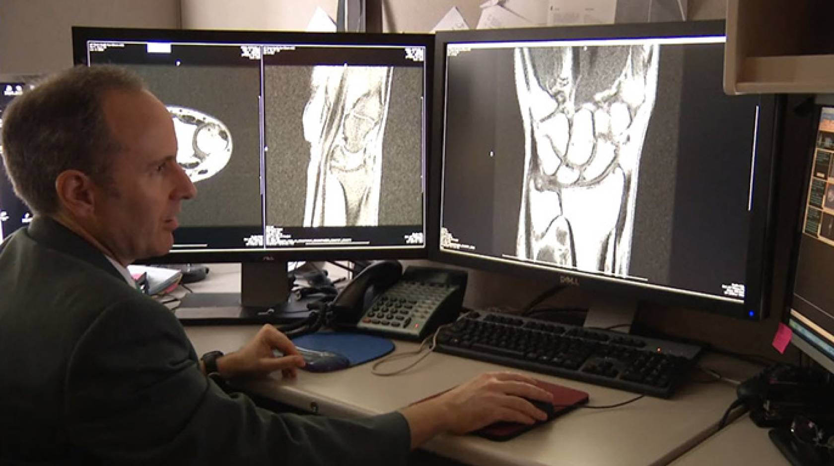 Robert Boutin, a UC Davis professor of radiology and specialist in musculoskeletal imaging. 
