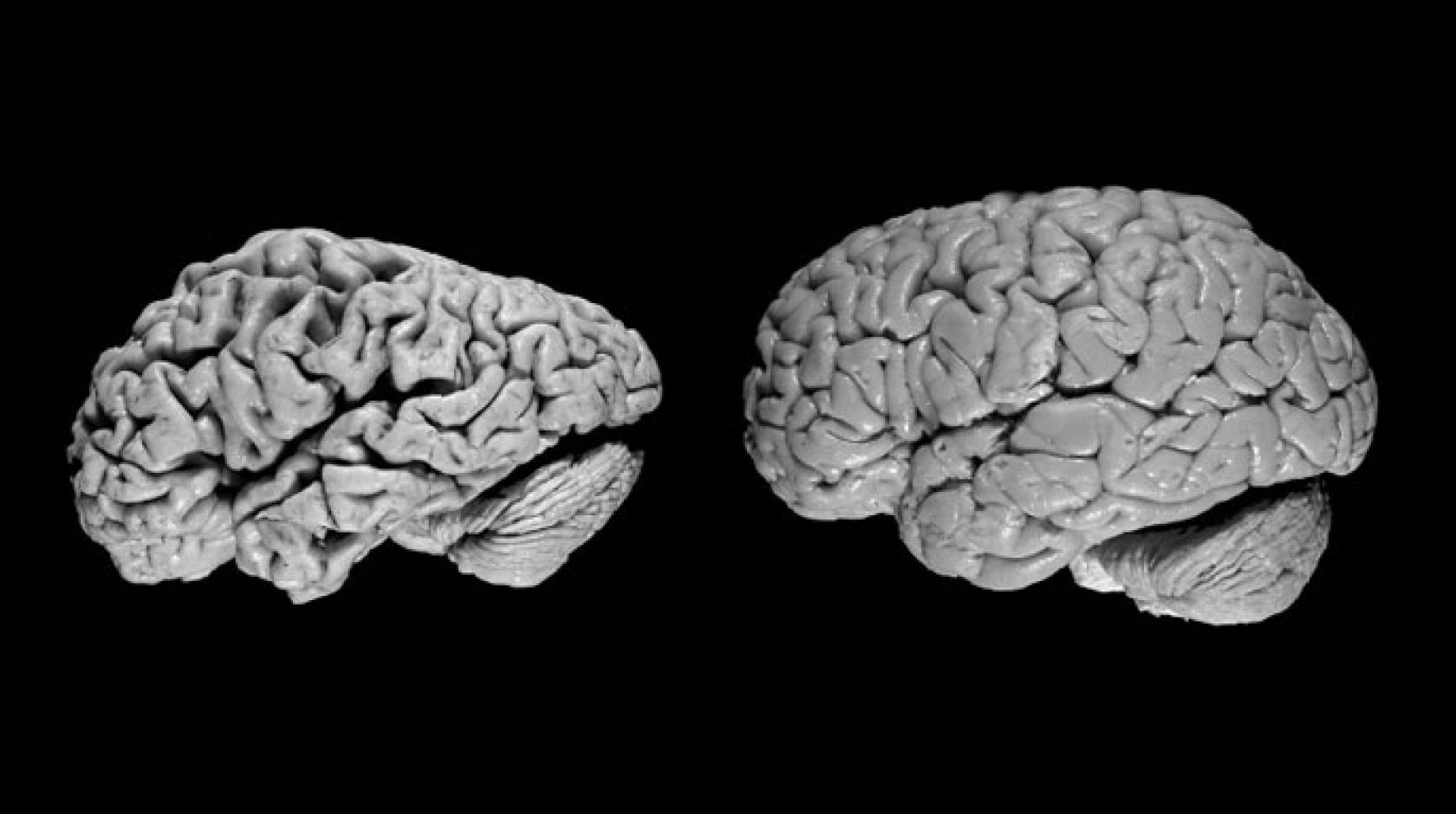A comparison of two brains
