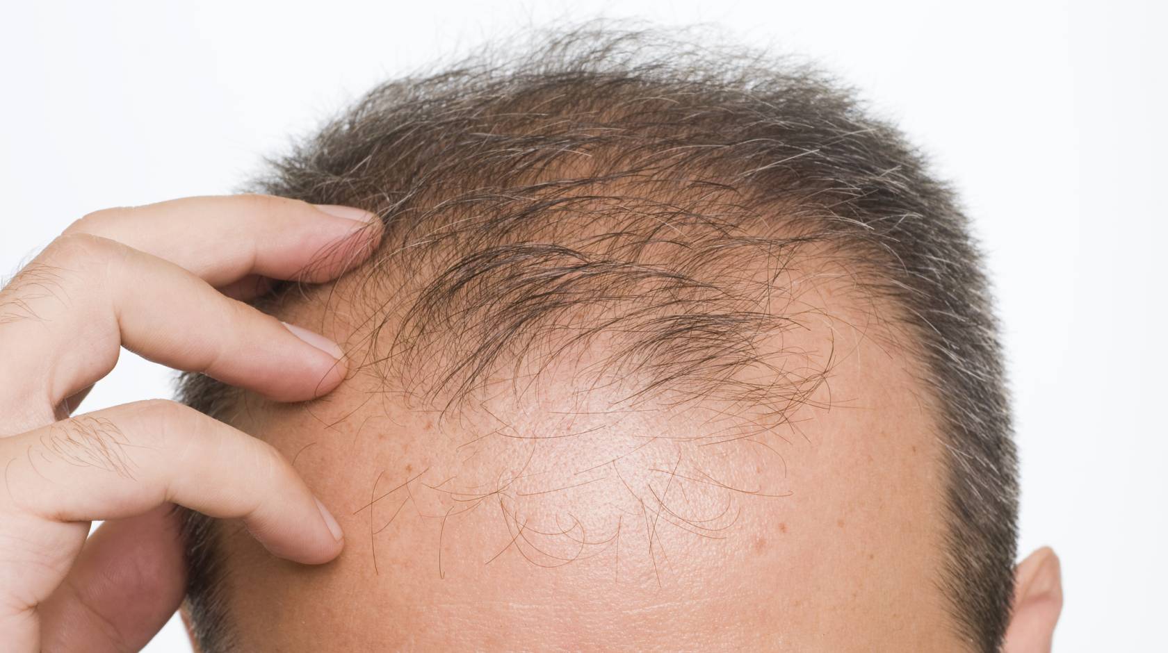 Man scratching bald head, only top of head visible