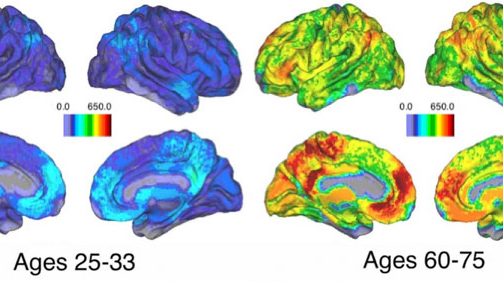 Brain activity UC Santa Barbara