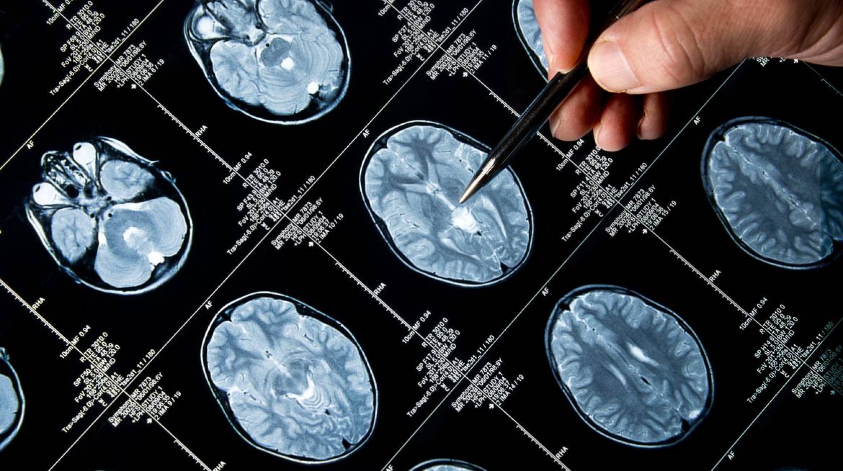 Brain scan images with a pen pointing