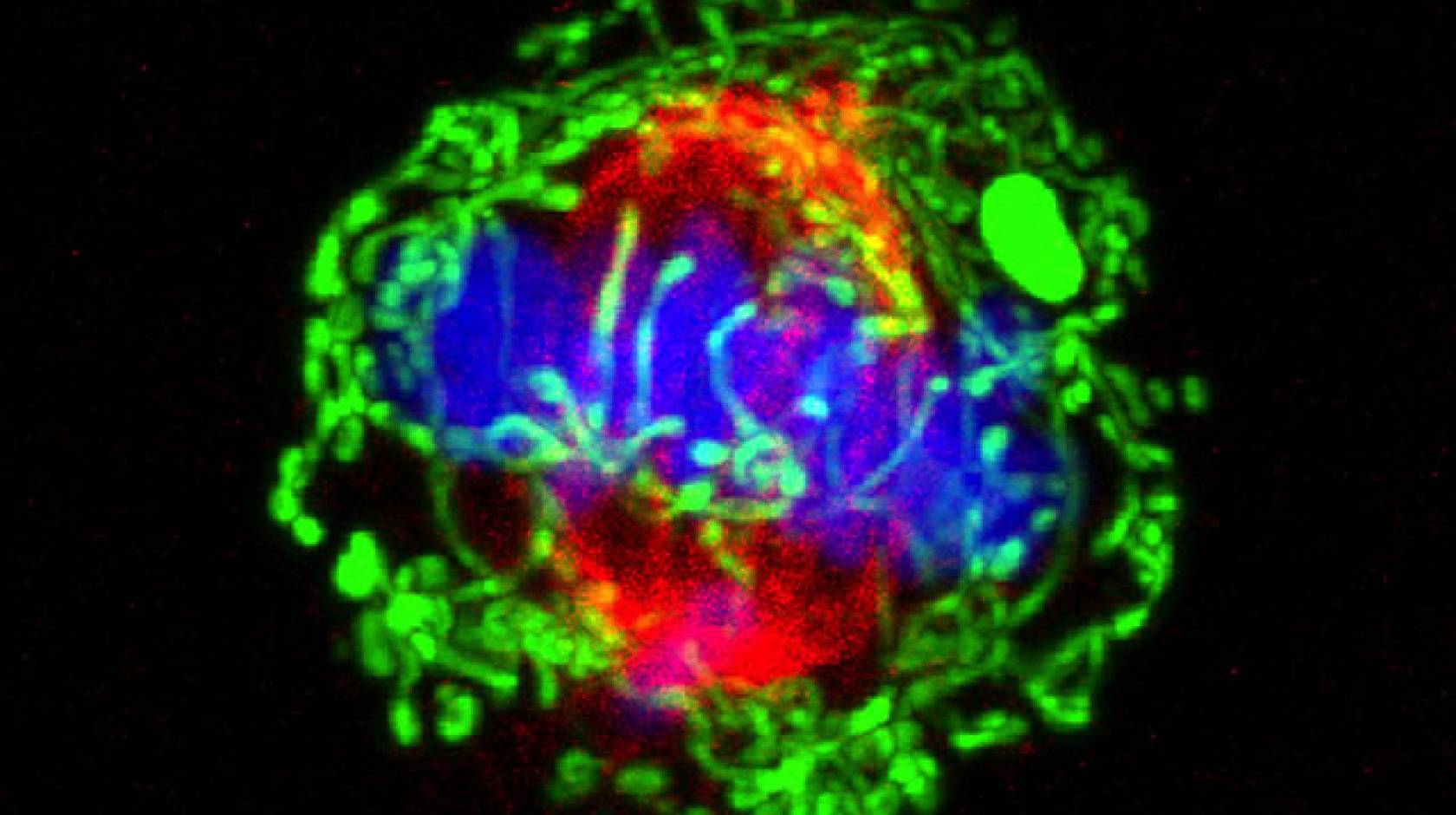 Dividing breast cancer cell