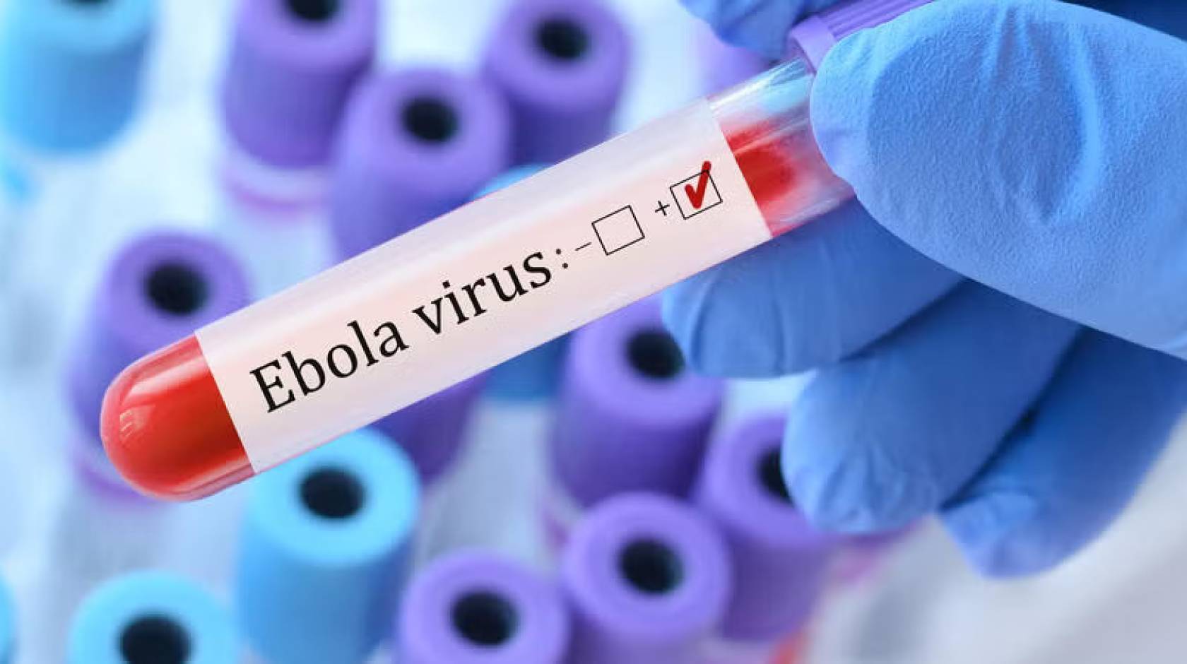 A pipette that says Ebola virus with a plus or minus check held by a gloved hand