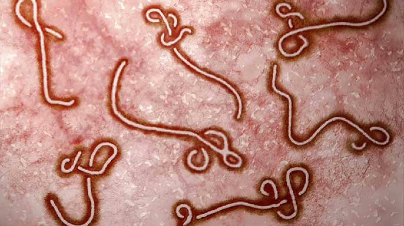 Ebola virus