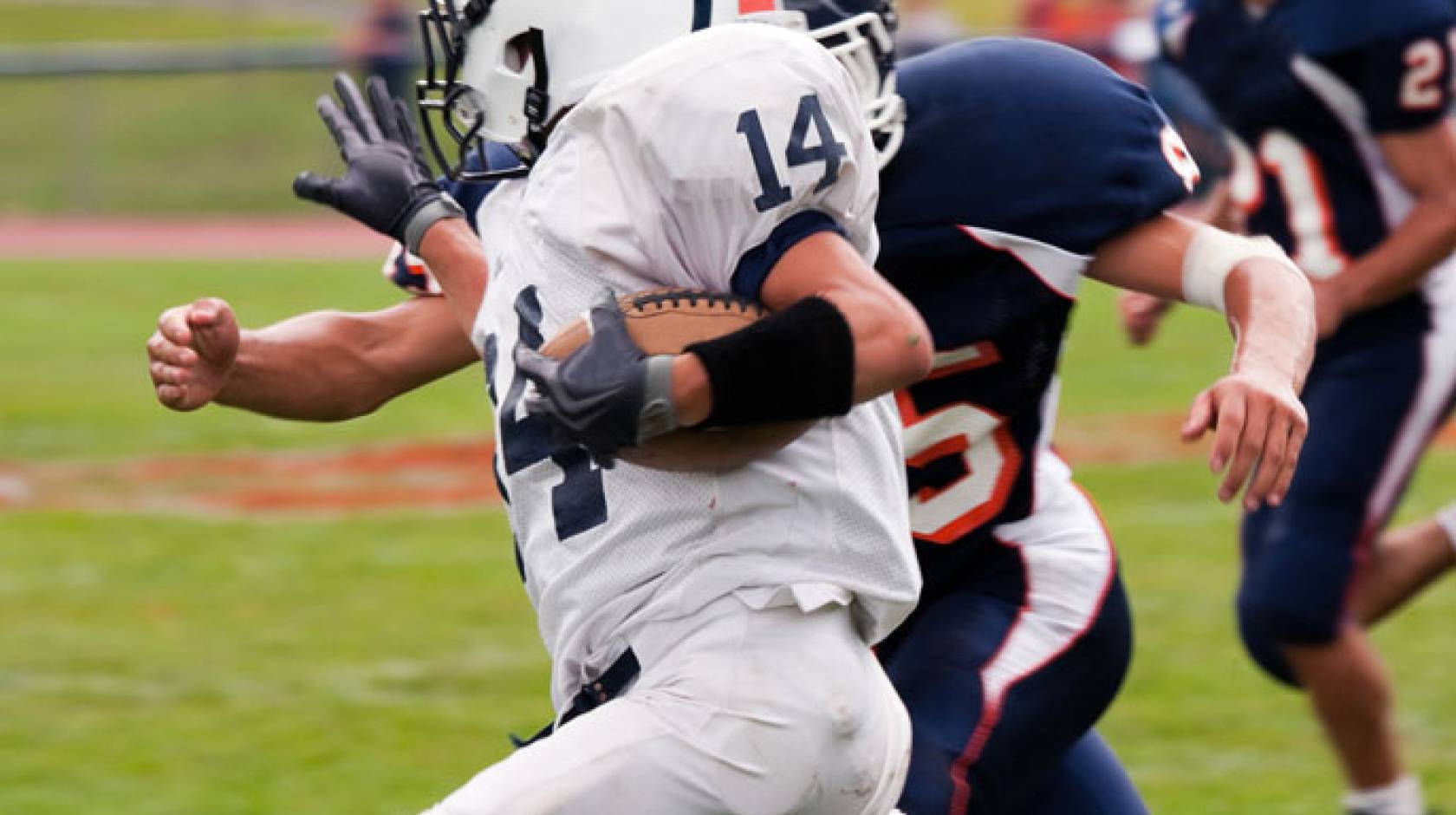 UCSF football concussions