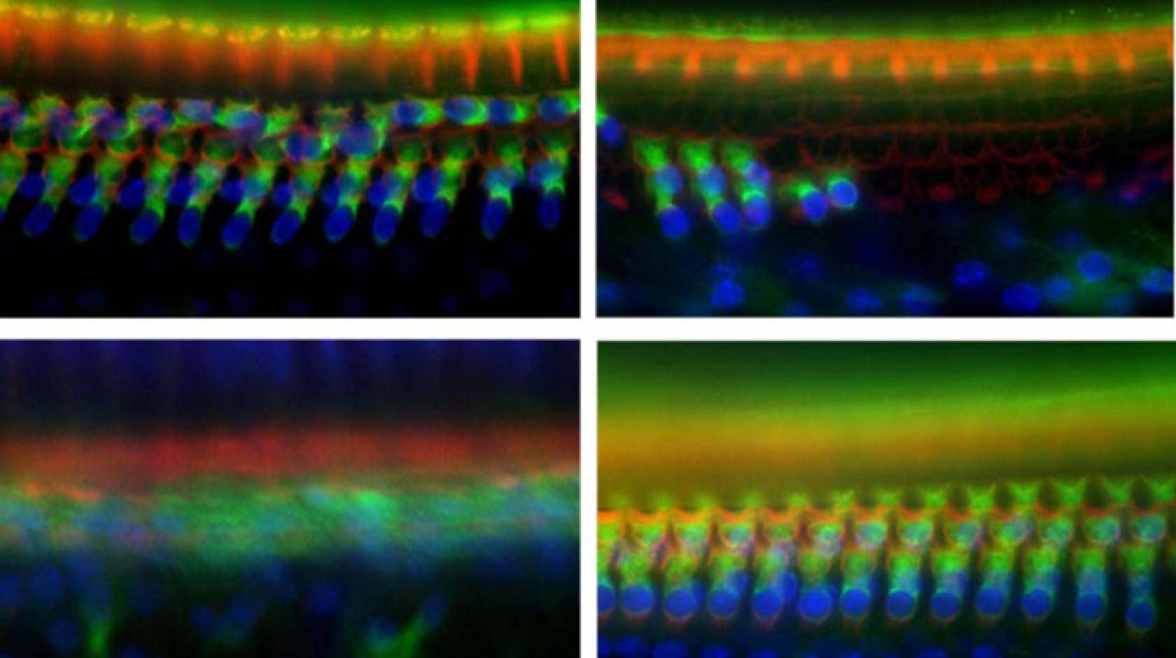 Four photos of hair cells relevant to the experiment