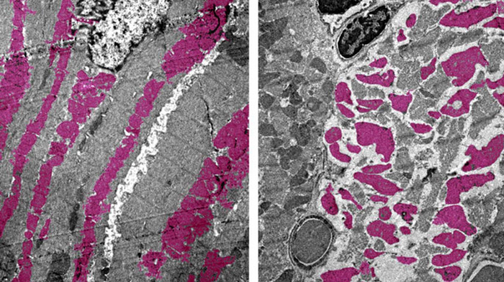 Heart muscle tissue close-up