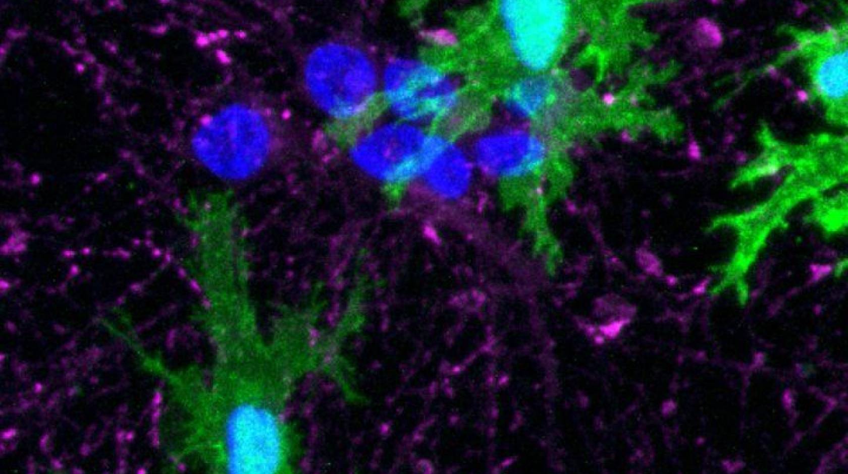 Close up image of microglia (green)