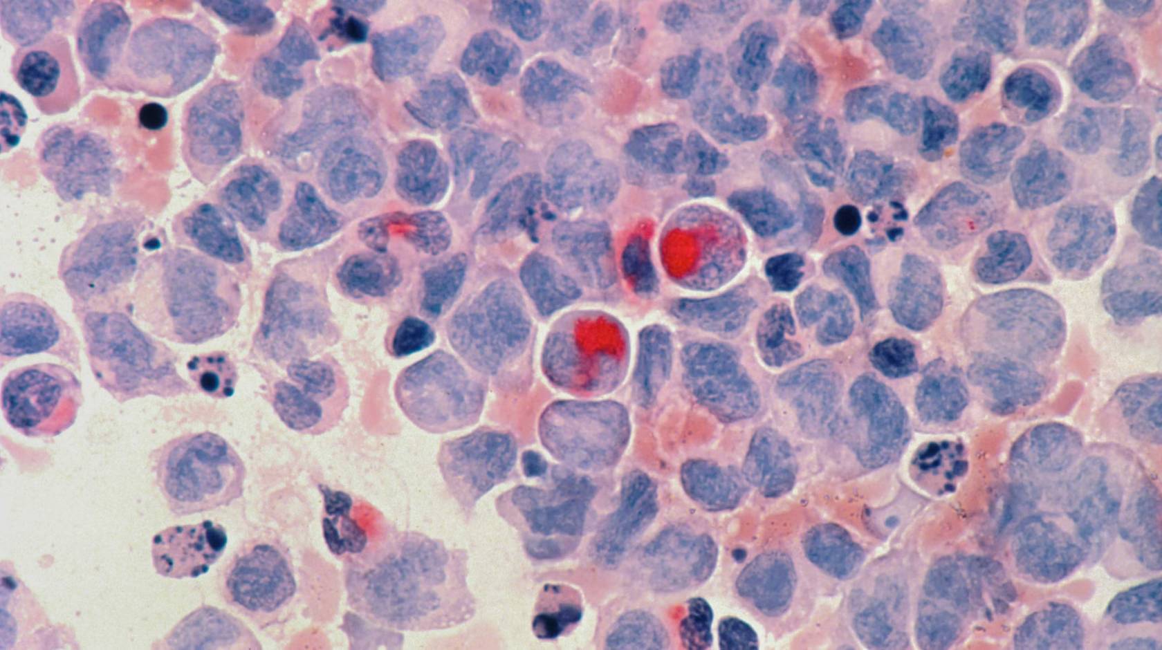 A microscopic view of purple and red cells